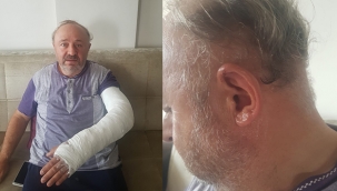 Sokak ortasında nacaklı dehşet 