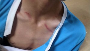 Hayvan otlatma meselesi kanlı bitti: 2 yaralı