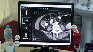 İhtiyaç fazlası kırmızı et tüketimi kanser riskini artırıyor 