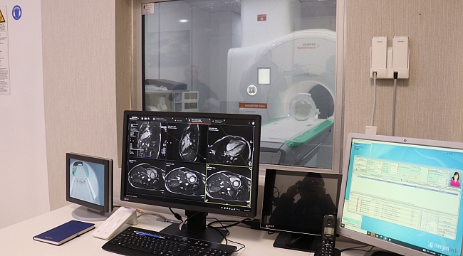 Yapay zeka destekli MR cihazı hizmete girdi 