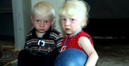 2 yaşındaki Suriyeli ikizlerin kararan dünyası aydınlığı bekliyor