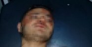Bıçaklanan genç ağır yaralandı