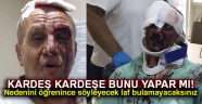 Kardeş kardeşe bunu yapar mı: Nedenini öğrenince söyleyecek laf bulamayacaksınız..