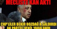 Meclis'te kan aktı, CHP'liler AK Partili vekilin kaşını yardı