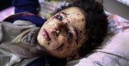 Suriye'de rejim ablukasındaki Doğu Guta'ya ölüm yağıyor