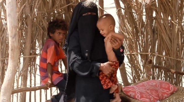 Yemen'de 22 milyon kişinin acil insani yardıma ihtiyacı var