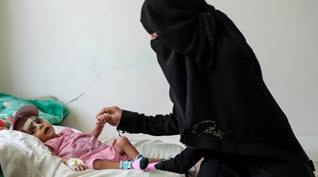 Yemen'de anne ve çocuklar ölüme terk ediliyor